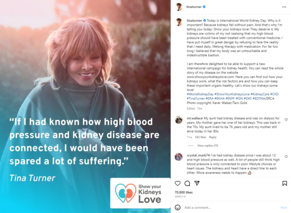 Tina Turner's Statement on high blood pressure and Kidney Disease - The Iconic Tina Turner on Instagram: A Look at Her Life and Music